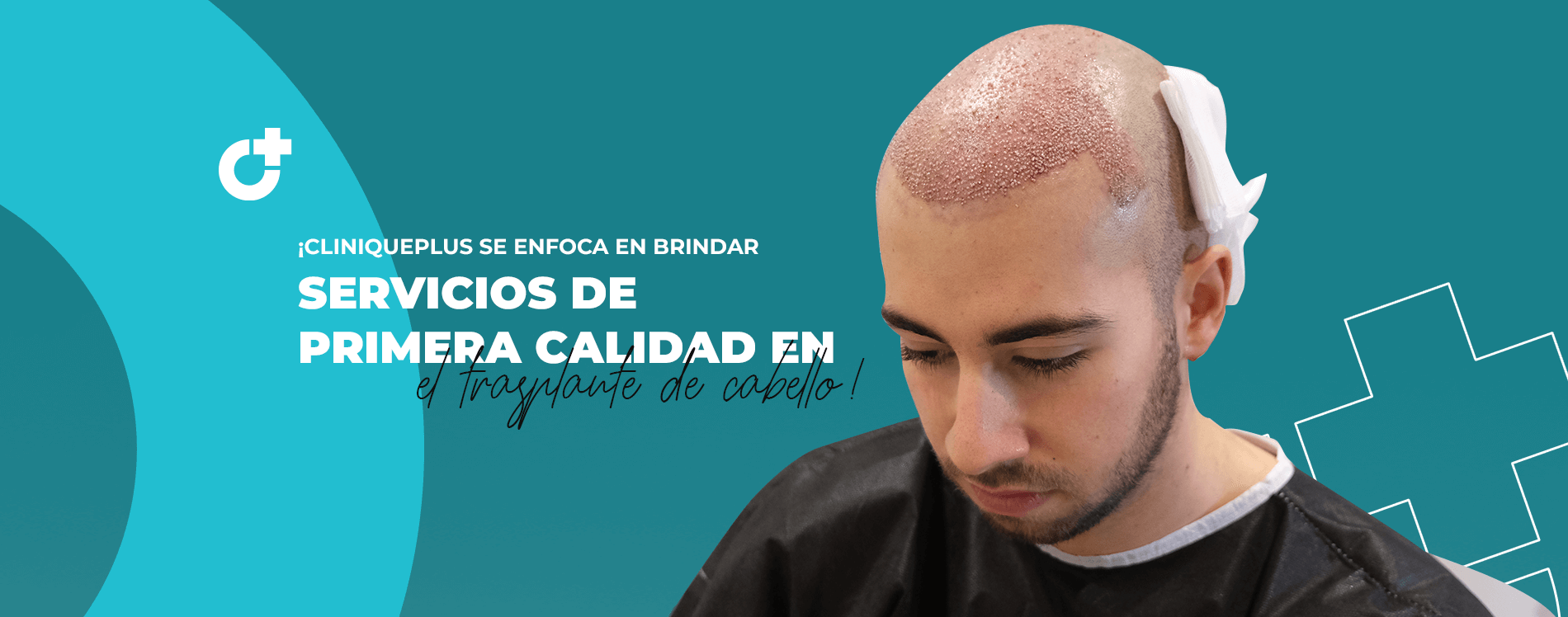 ¡CLINIQUEPLUS se enfoca en brindar servicios de primera calidad en el trasplante de cabello!