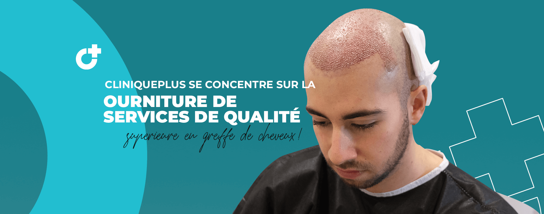 CLINIQUEPLUS se concentre sur la fourniture de services de qualité supérieure en greffe de cheveux !