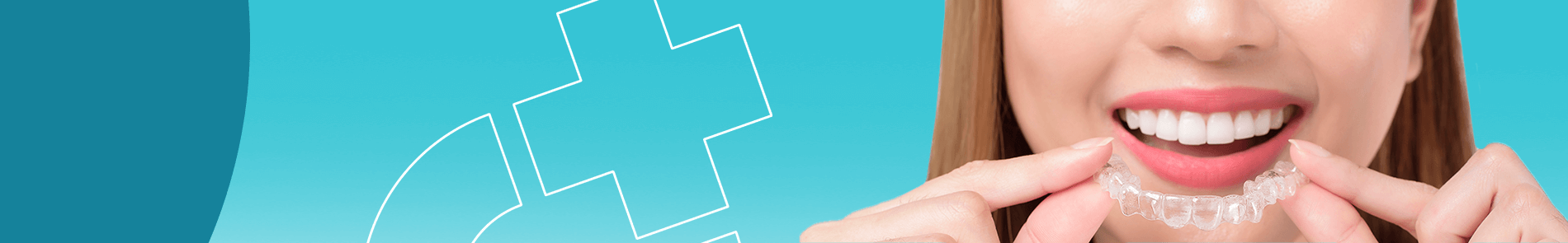Invisalign
