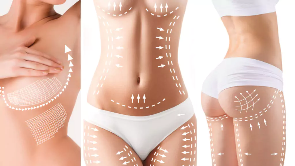 What is Mommy Makeover Surgery?