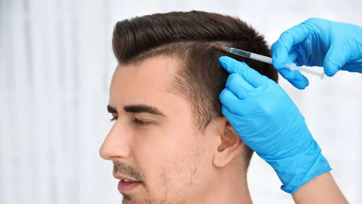 What is Hair Transplantation?