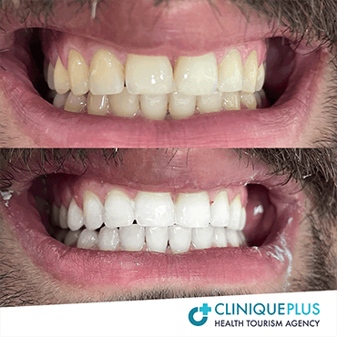 Dentisterie Cosmétique1