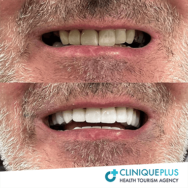 Dentisterie Cosmétique2