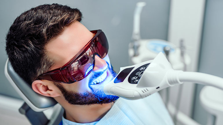 How Long Does Teeth Whitening Last?