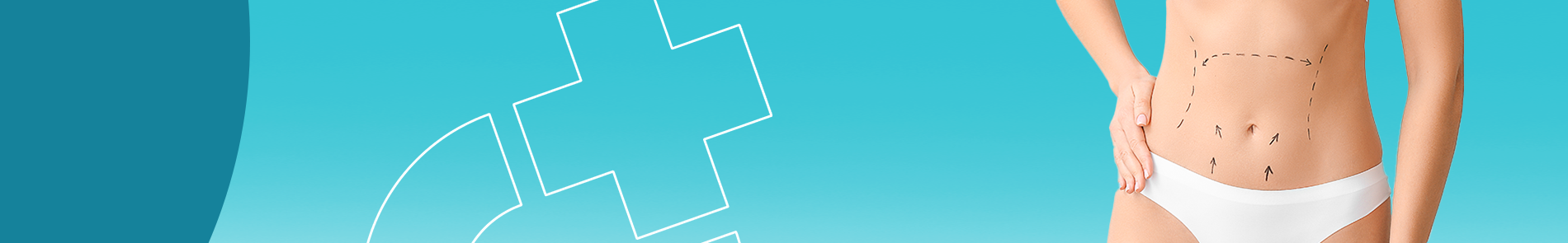 Bauchdeckenstraffung